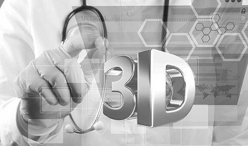 RF(tun)3Dӡ㲿_(d)f(wn) ®a(chn)ƷڌRi8܇(ch)